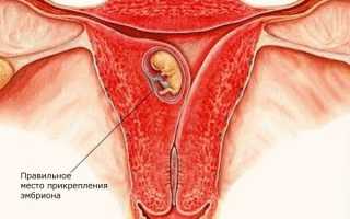 Месячные в первый месяц беременности: возможные причины и симптомы