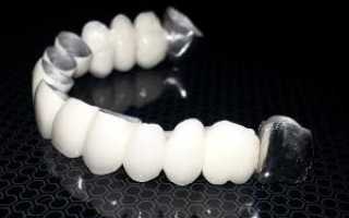 Обзор керамических коронок на передние и жевательные зубы: фото до и после протезирования