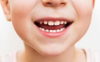 Какие зубы называют глазными, как прорезаются и сколько лезут верхние клыки, как помочь ребенку?