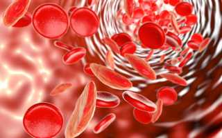 В-12 дефицитная анемия – основные симптомы и лучшие методы лечения