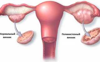 Задержка месячных: физиологический менструальный цикл и его нарушения