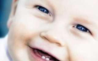 Ребенку 10 месяцев и нет зубов — почему так происходит, какие причины называет Комаровский и что делать?