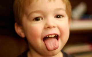Причины желтого налета на языке у ребенка — почему так бывает у детей и в чем заключается лечение?