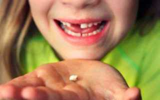 Как в домашних условиях вырвать шатающийся молочный зуб у ребенка правильно, быстро и без боли?