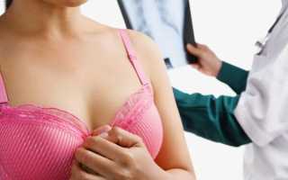 Симптомы рака груди у женщин и способы борьбы с опасным заболеванием