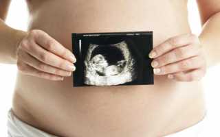 Брадикардия плода при беременности: причины и лечение