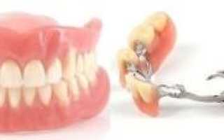Подготовка зубов и полости рта к протезированию и другие этапы процедуры: с чего начинается и как проходит лечение?