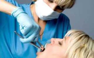 Сколько зубов можно удалить за одно посещение стоматолога под местной анестезией и общим наркозом?