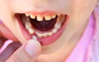 Как удаляют молочные зубы, будет ли больно ребенку, каковы показания и последствия и что делать после процедуры?