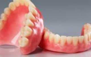 Какие зубные протезы лучше выбрать при полном отсутствии зубов: варианты протезирования челюсти