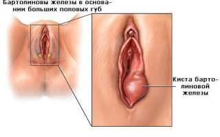 Чешутся половые губы у женщин: причины и способы лечения