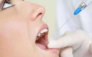 Насколько больно сейчас лечить зубы: всегда ли лечение сопровождается обезболивающим уколом?
