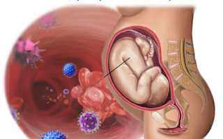 Цитомегаловирус при беременности: причины, симптомы, лечение и последствия для плода