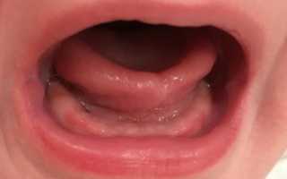 Почему у ребенка могут не по порядку лезть зубы, что предпринять, каково мнение доктора Комаровского?