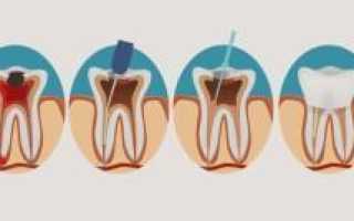 Сколько корневых каналов в зубах человека: анатомия и функции, таблица и схема расположения